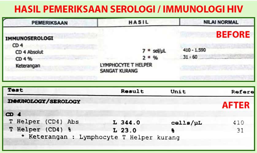 Penderita HIV-AIDS kembali Sehat